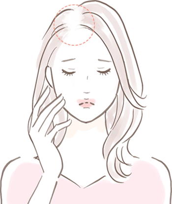 薄毛治療（男性型脱毛・女性）｜美容皮膚科