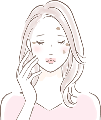 しみ|美容皮膚科"